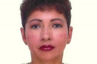 Ohren anlegen Bild nach OP 3